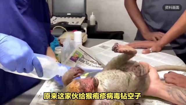 香港首例人类感染猴疱疹病毒