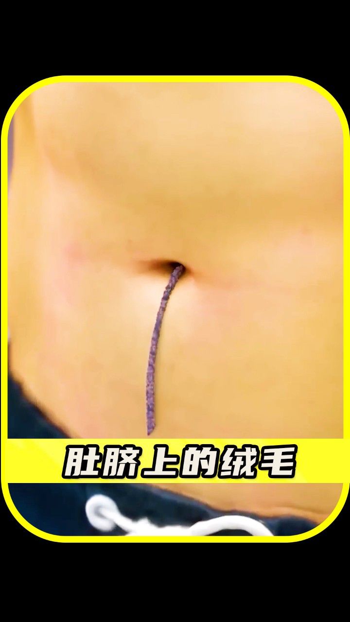 肚脐上的绒毛