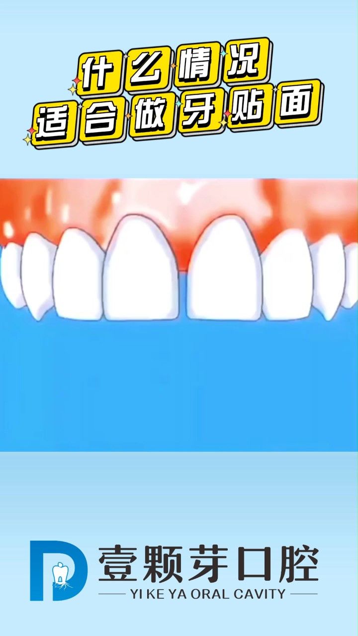 胶州玉齿牙科价目表图片