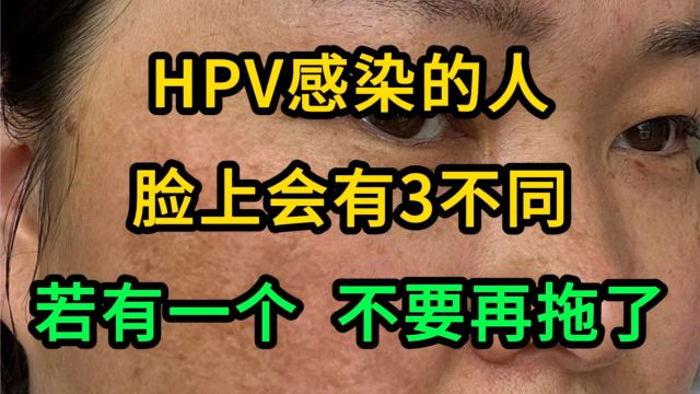 HPV感染的人,脸上会有3不同,若有一个,不要再拖了