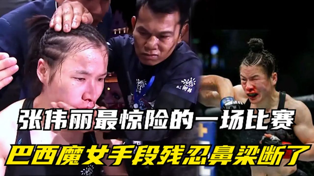 张伟丽最惊险的一场比赛,巴西魔女手段残忍,连张伟丽鼻梁都打断