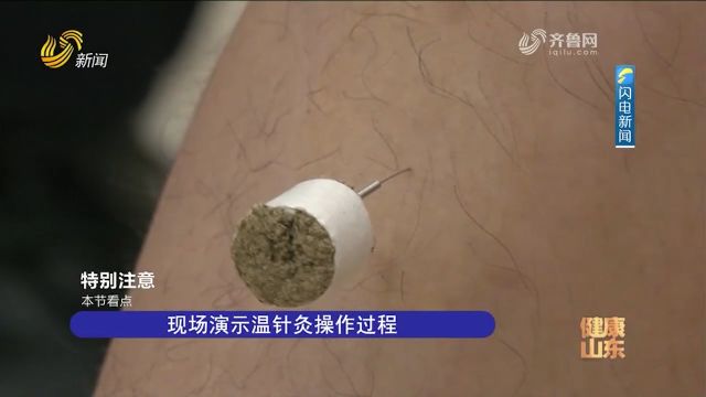 艾柱挂在针柄上?专家现场演示温针灸操作过程,讲述温针灸原理