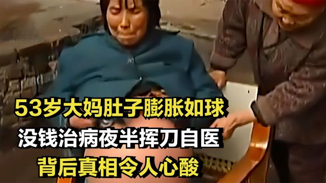 53岁大妈肚子膨胀如球,没钱治病夜半挥刀自医,真相却令人心酸