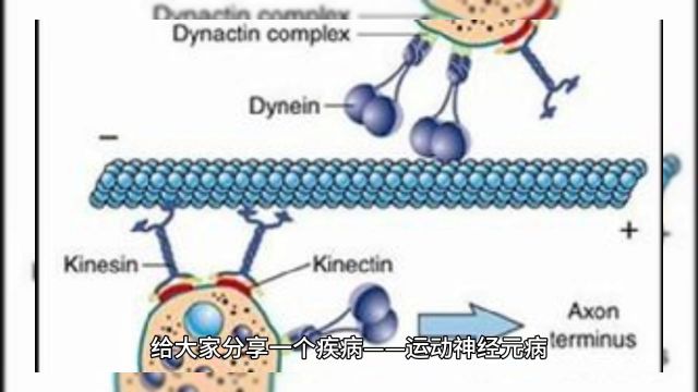 运动神经元病(Motor Neuron Disease,简称MND)是一种神经系统疾病,主要影响运动神经元,这些神经元负责控制肌