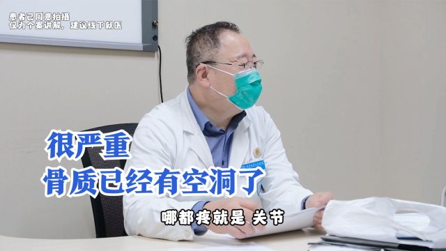 肘关节疼痛,被当地医院诊断为关节炎,男子:开了药但用完没效果