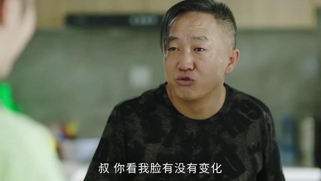 小琴整容后续,