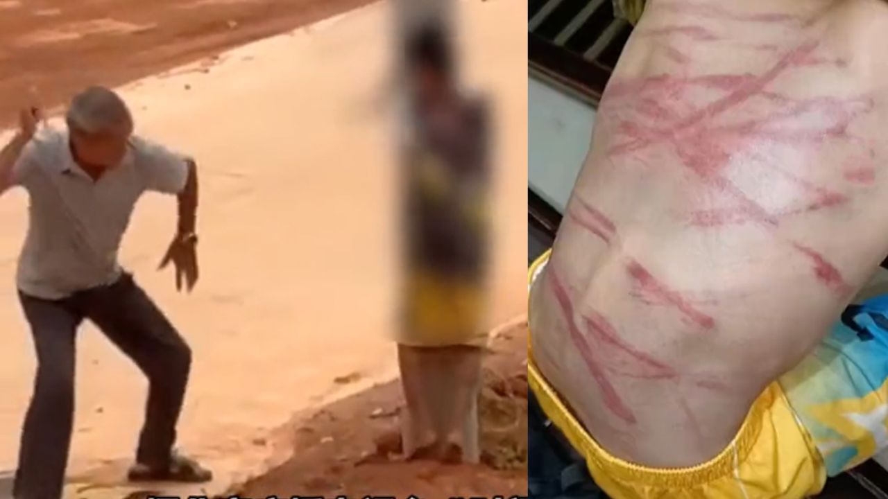 男孩被怀疑偷钱被绑在电线杆上抽打:背部有多条血痕,遍体鳞伤