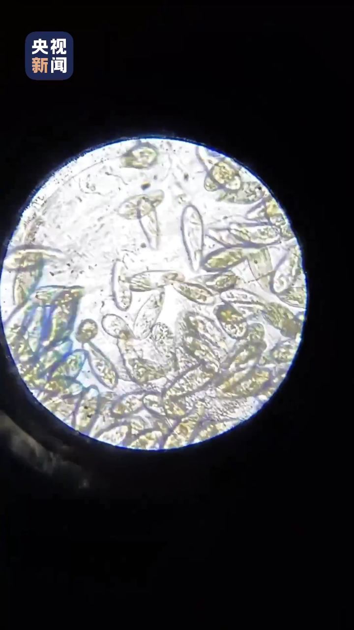 好酷!初中生不到20元成本"手搓"显微镜看到了草履虫