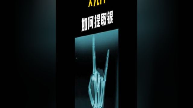 原来去医院拍的X光片是这么值钱的