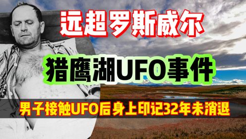 远超罗斯维尔事件，男子触摸UFO后被烧伤，身上烙印32年未消退！