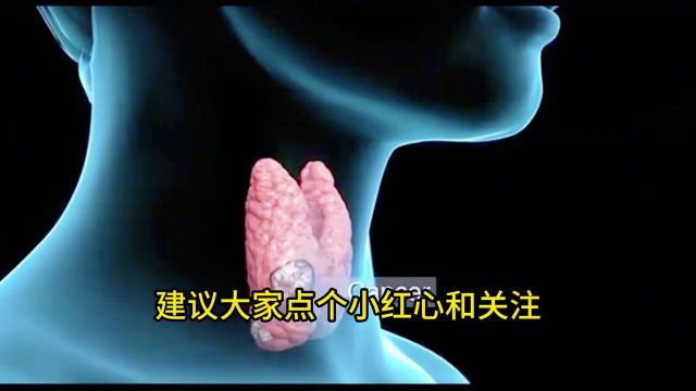 我再说一次,甲状腺结节是可以治好的