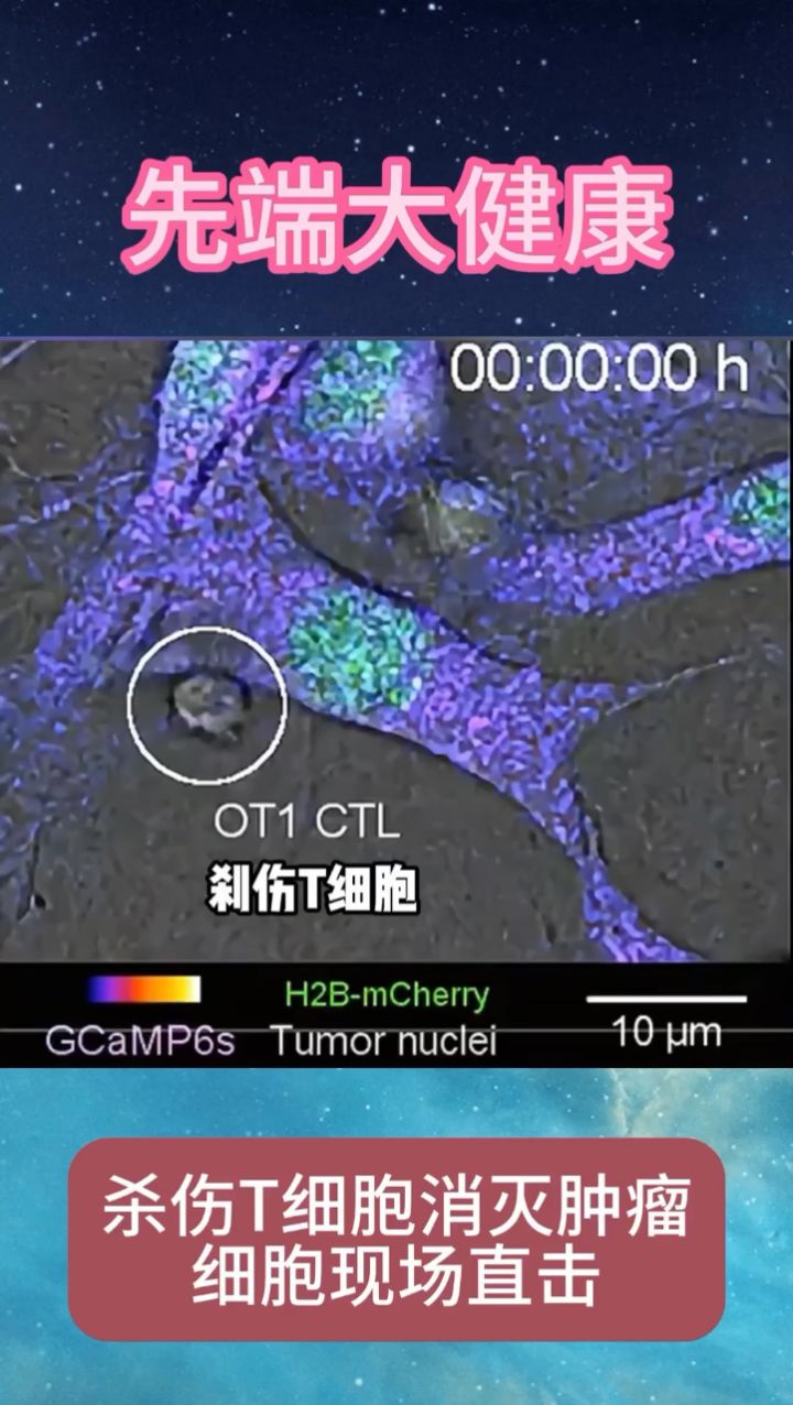 杀伤t细胞在线消灭肿瘤细胞,干细胞治疗抗癌