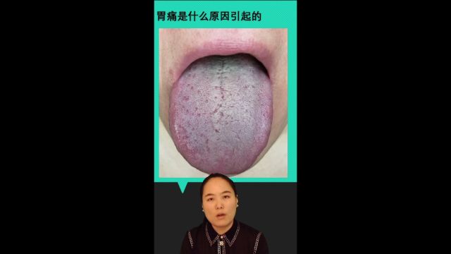 29胃痛是什么原因引起的 易演伤寒论公开课