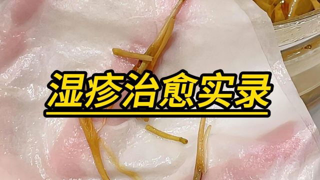 湿疹治愈实录,皮肤变化全过程大揭秘!