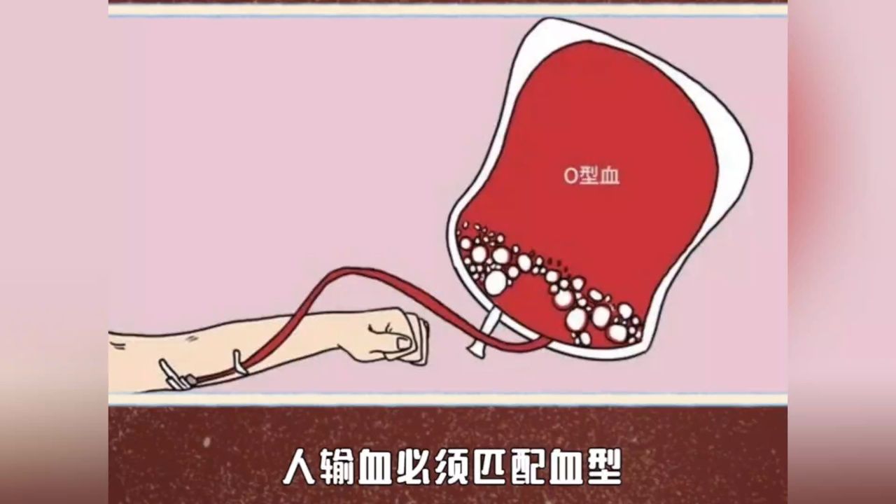 狗子能随便输血不管血型吗?