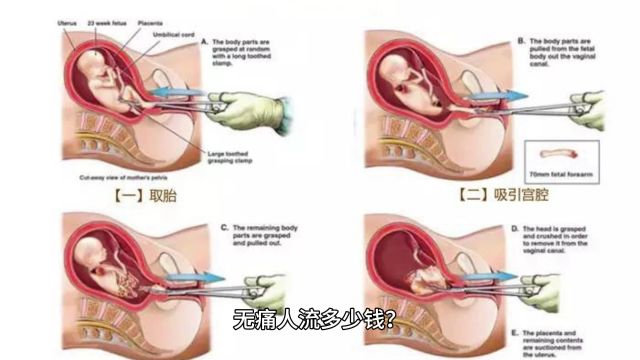 重庆铭博计划生育定点中心:无痛人流多少钱?