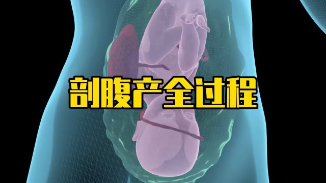 剖腹产全过程,每个妈妈都伟大