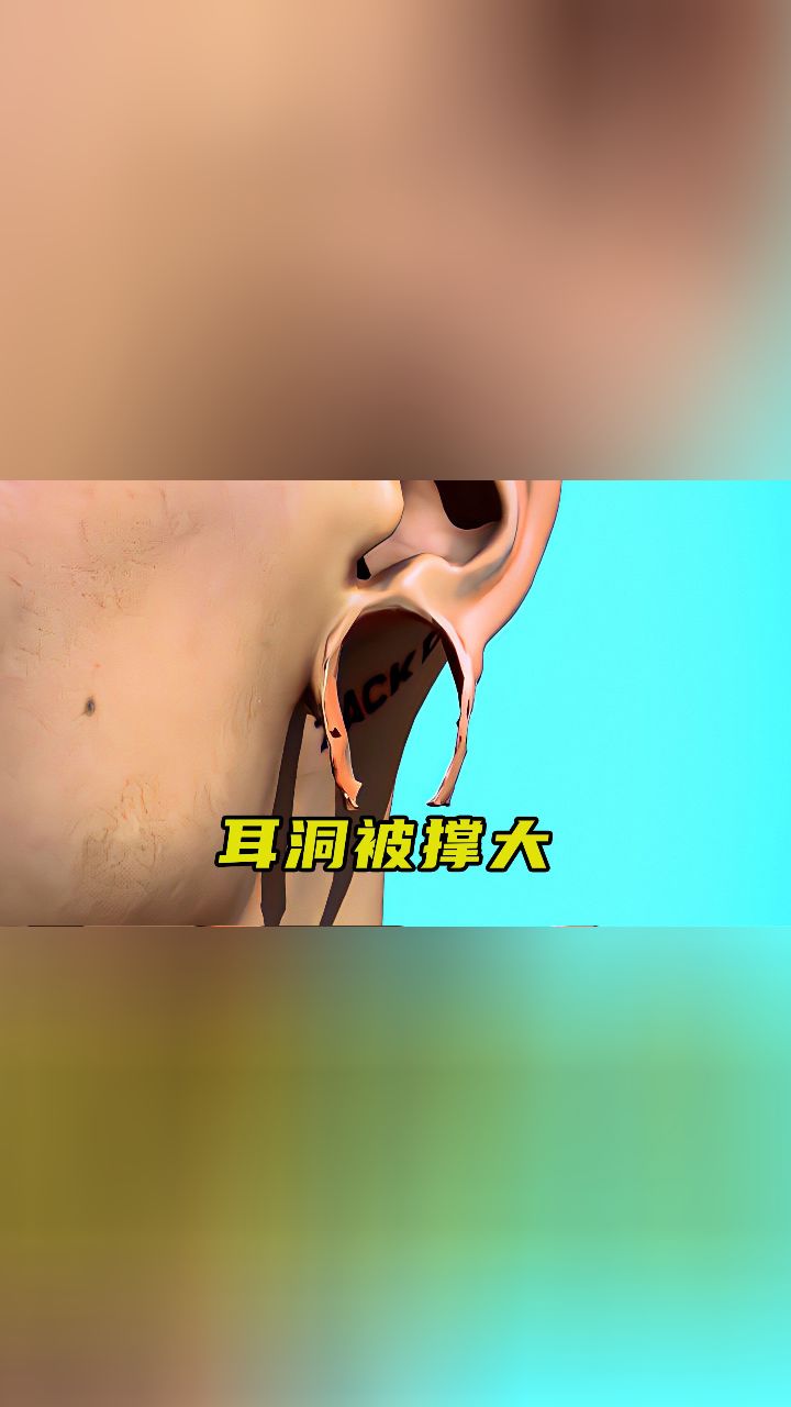 非洲女人的大耳洞都是怎么形成的?