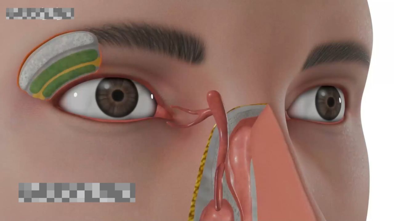 泪道解剖_高清1080P在线观看平台_腾讯视频