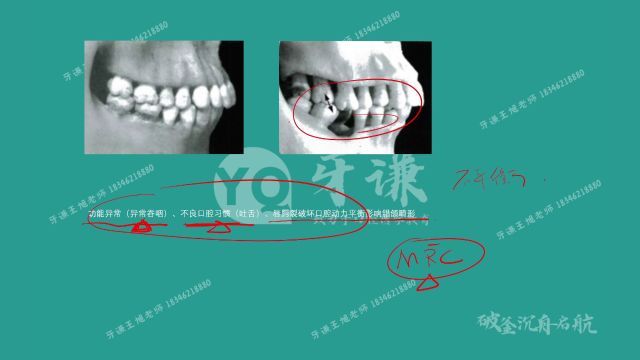 牙谦教育口腔执业含助理医师考试第二轮口腔解剖生理学第二节𐬌—与𐬌—位