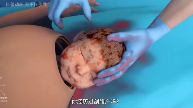 女性剖腹产的全过程,看完一定要好好爱自己的妈妈,致敬每一位母亲!#剖腹产 #孕期 #科普知识 #涨知识.mp4