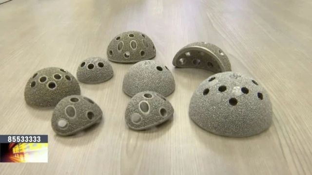 3D打印“量身定制”骨骼假体 构建能生长的人工骨骼