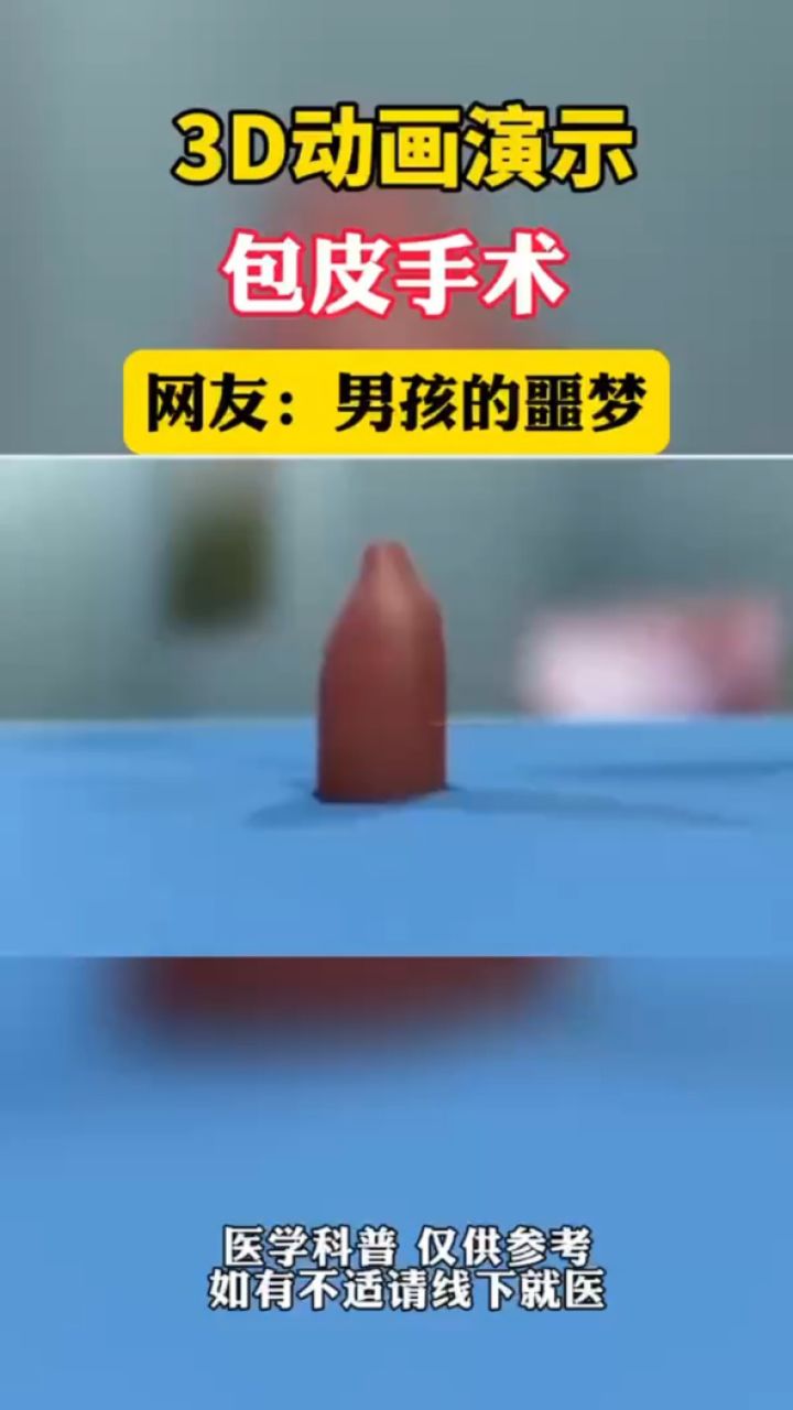 大连美琳达妇产-不开刀非手术治疗包皮包茎
