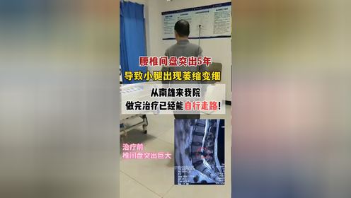 腰椎间盘突出最好的治疗方法-广州东方医院骨科