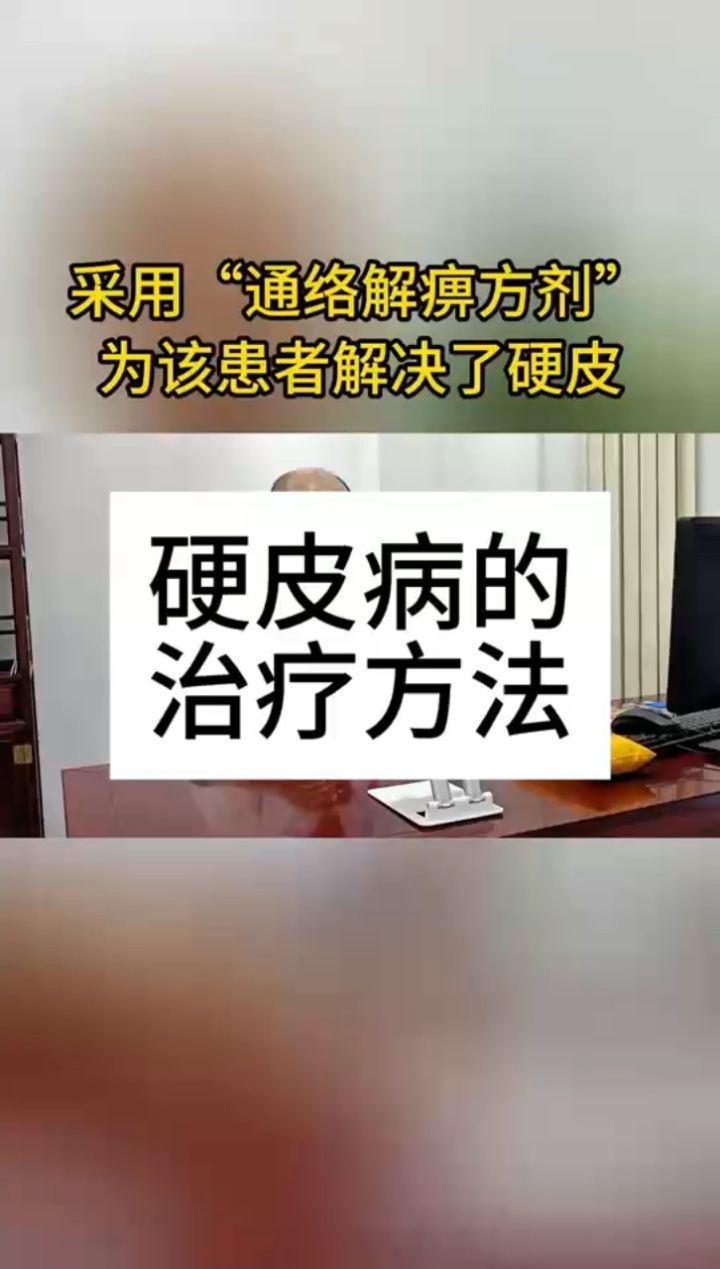 硬皮症图片 治疗方法图片