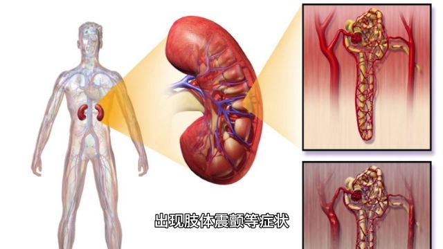 特发性震颤与肝肾有什么关系呢?