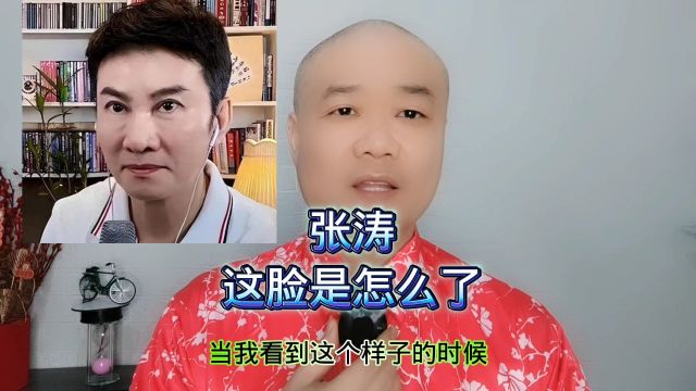 张涛:这脸是怎么了!