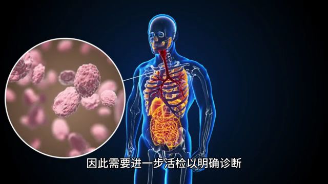 曹文兰乳腺结节3类和三级有什么区别