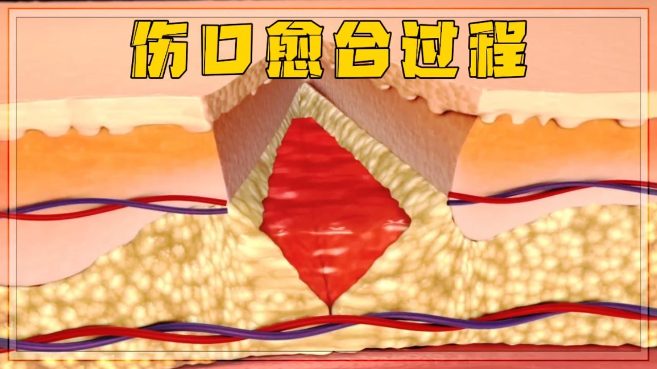  1080P 