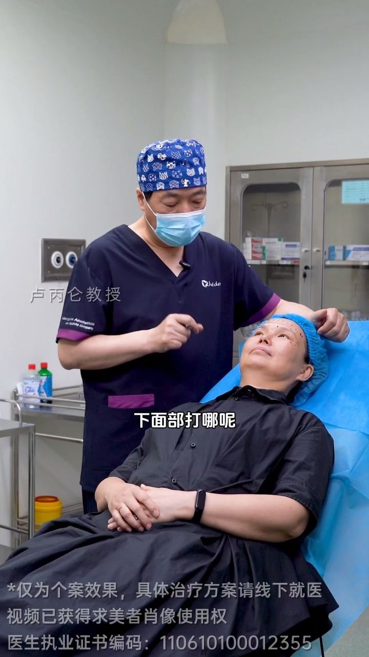 肉毒素注射之颈阔肌液态提升抗衰