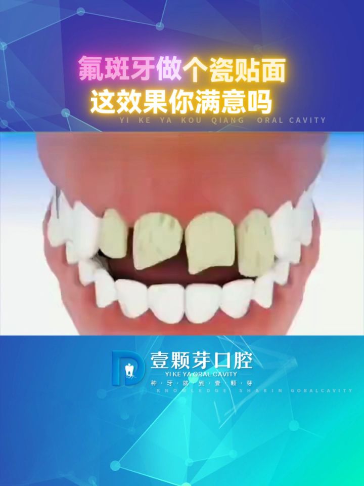 好牙依口腔连锁价目表图片