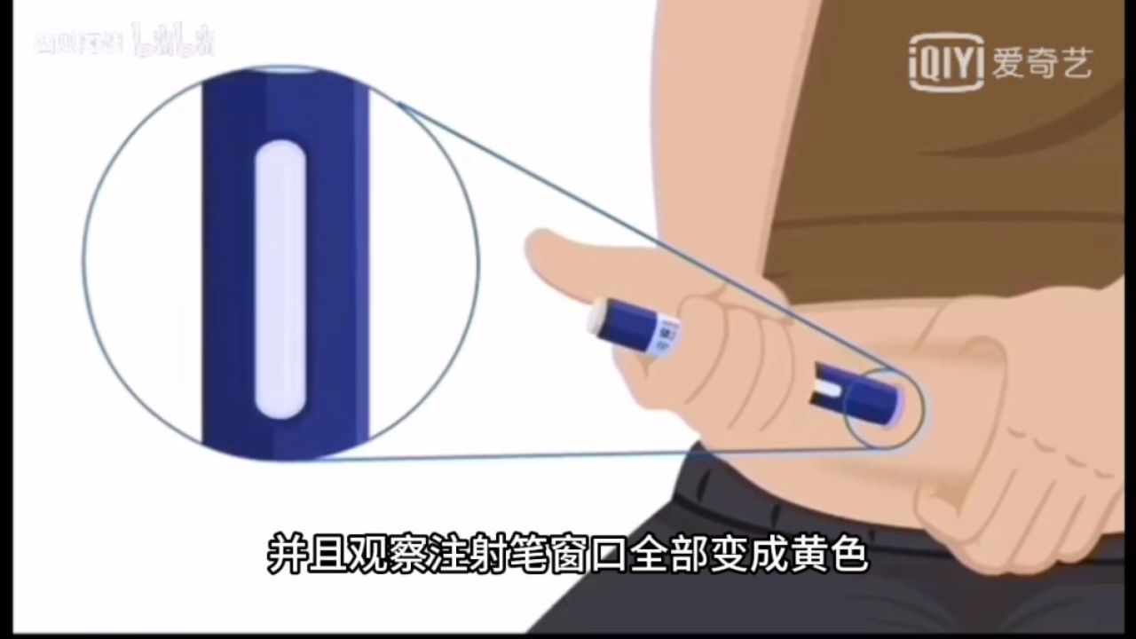 伊洛尤单抗注射流程_高清1080P在线观看平台_腾讯视频