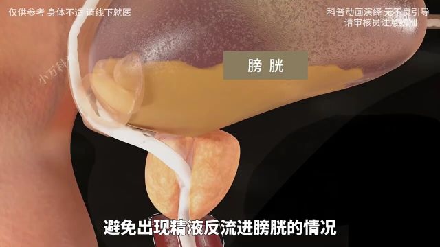 男性跑马是如何形成的?其实它只是男性的一个正常生理现象