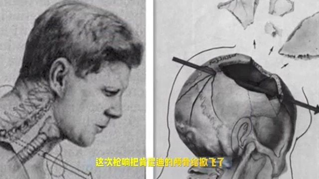 1963年美国总统肯尼迪遇刺,暗杀原因成了美国历史最大的悬案(下)