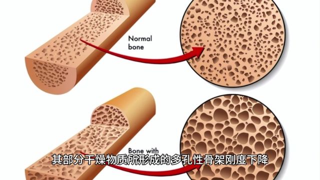 真空冷冻干燥机升华干燥的定义以及样品玻璃态温度相关