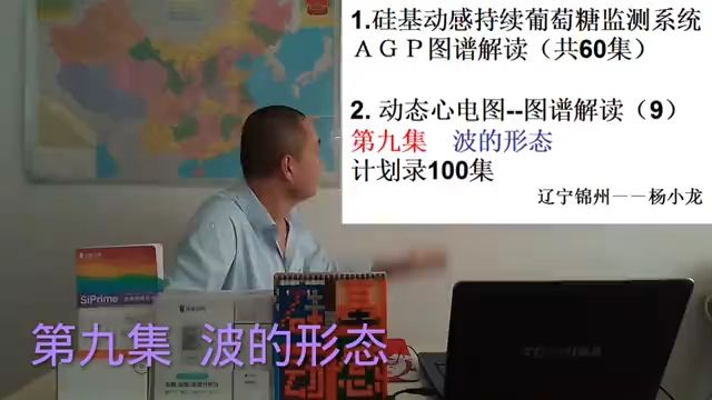 动态心电图图谱解读 第九集 波的形态 计划录100集