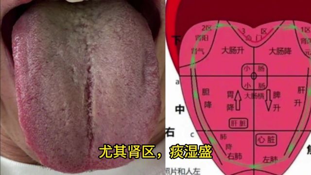 能力差、力不从心怎么办?健脾、疏肝、活血,让你生龙活虎