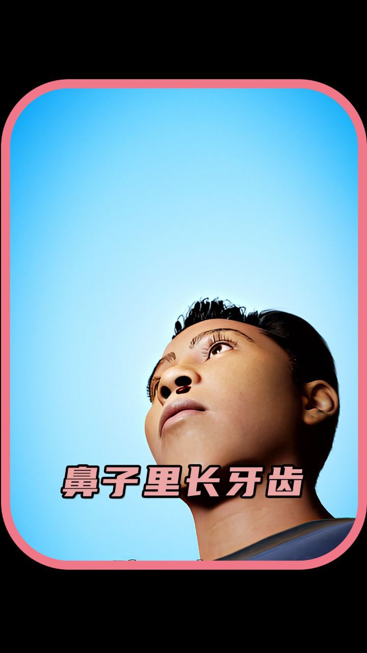 你见过鼻子里长牙齿的吗?