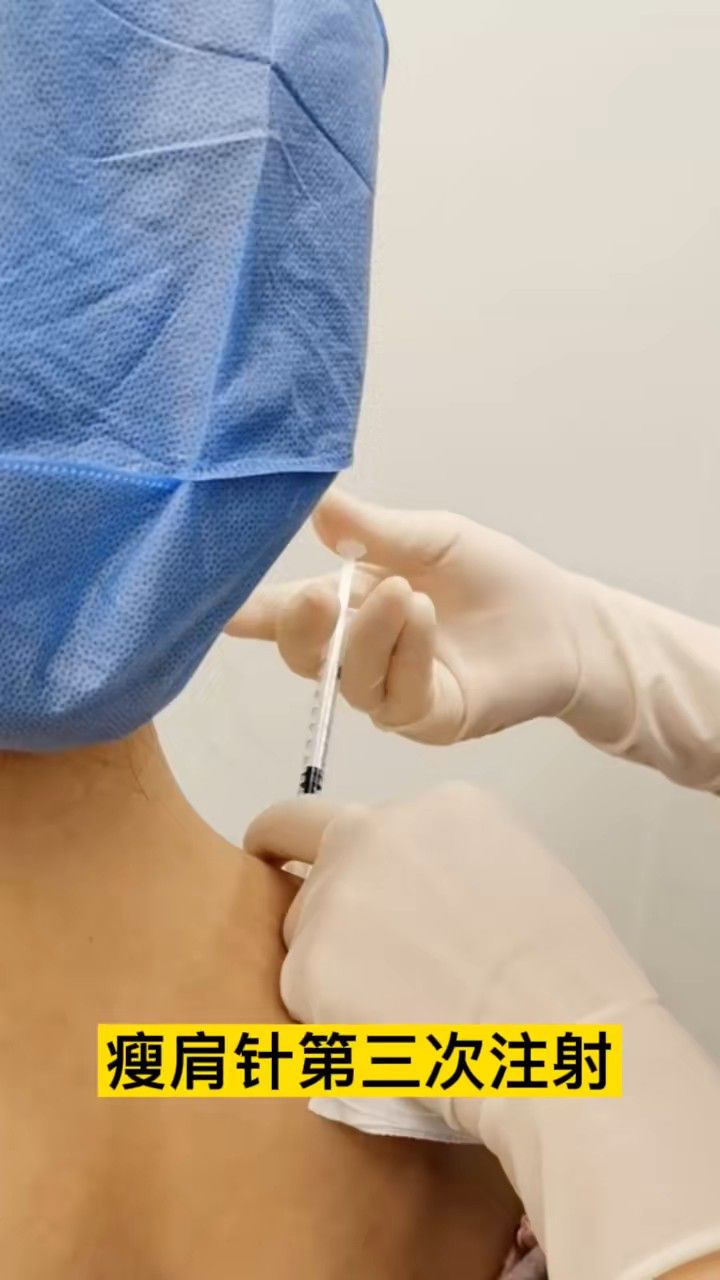 瘦肩针第三次注射