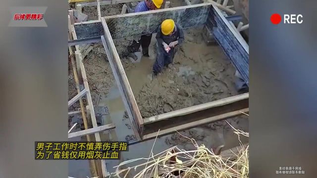 男子工作时不慎弄伤手指,为了省钱仅用烟灰止血