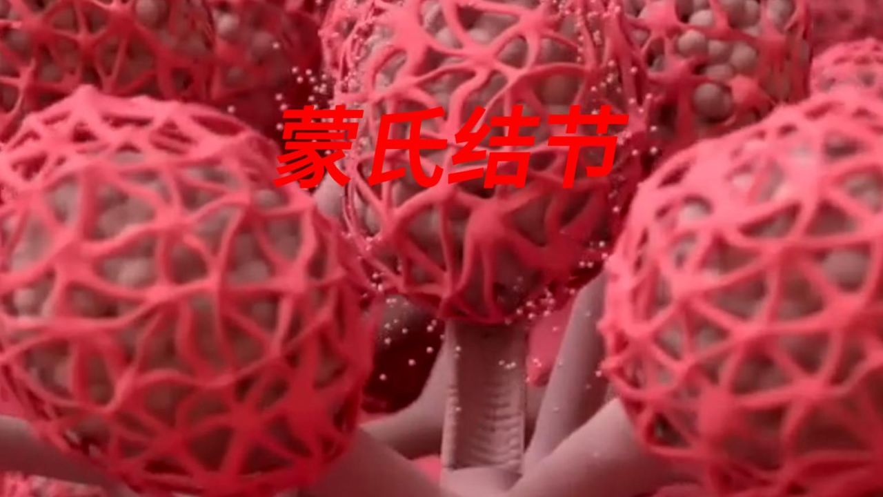 你知道什么是蒙氏结节吗?女生的"小秘密"你知道吗?