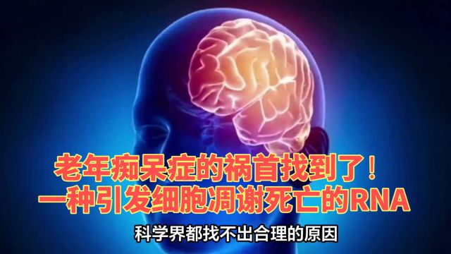 老年痴呆症的祸首找到了!一种引发细胞凋谢死亡的RNA