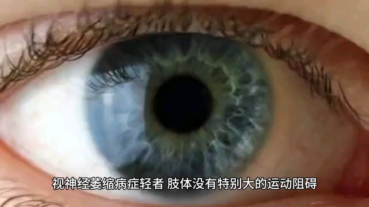 视神经萎缩病人不要放弃!