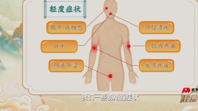 患有轻度和中度的干燥综合征都有哪些症状?