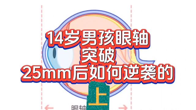 妈呀!眼轴突破了25毫米,看他是如何逆袭成功的(上)