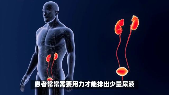 邯郸燕赵中医院中医科王琳瑛中医水平尿潴留的症状